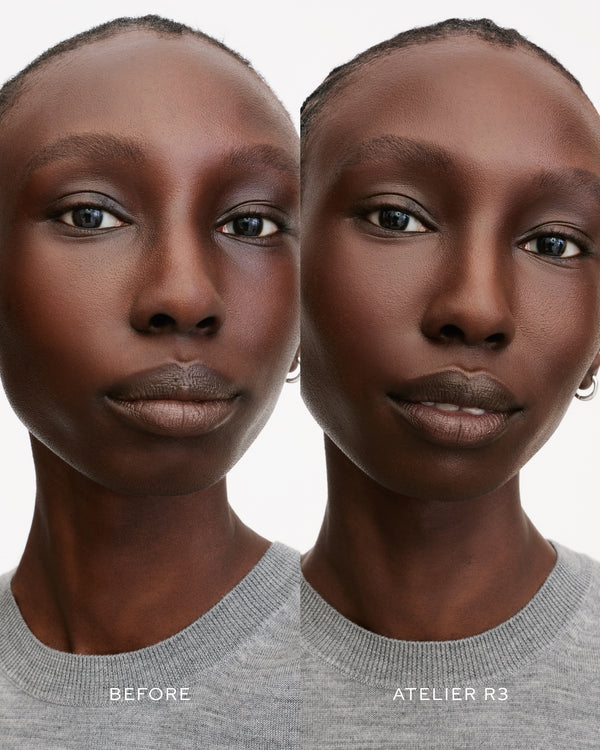 R3 B&A