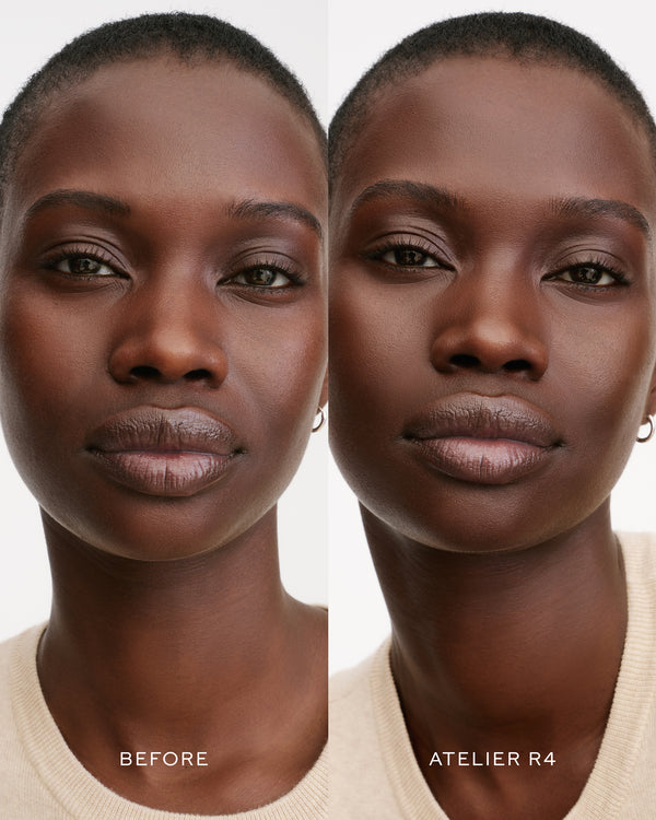 R4 B&A
