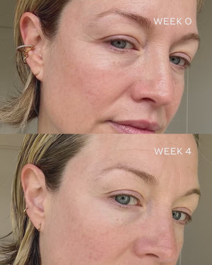 Before and after video of model using Eye Activator after 4 weeks.